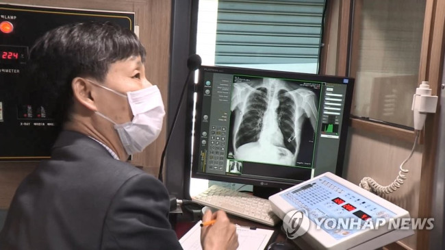 결핵 검진