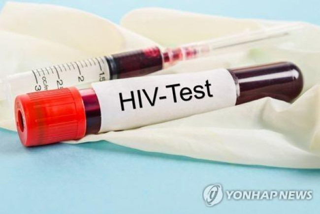 인간면역결핍바이러스(HIV) 검사