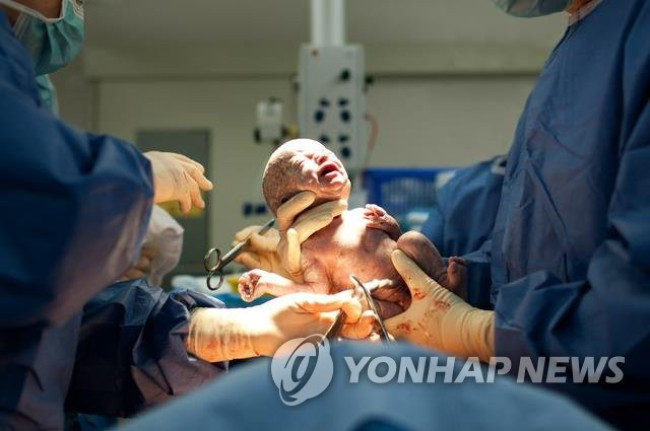 제왕절개