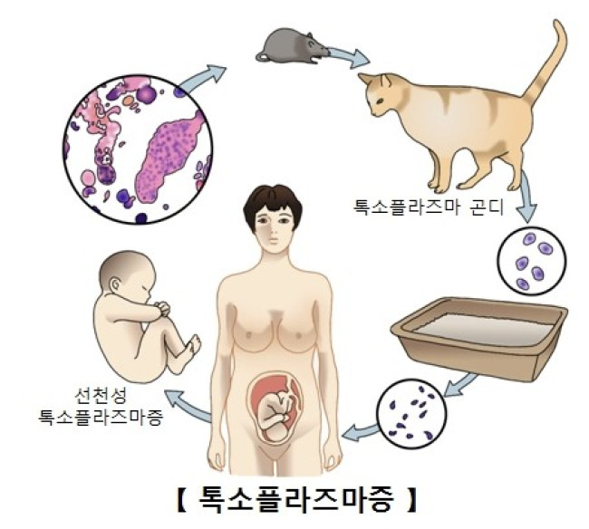 톡소플라즈마증 감염 경로