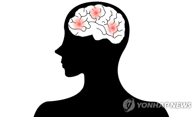 뇌졸중 뇌출혈(일러스트)