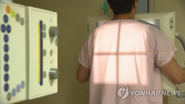 결핵 검진