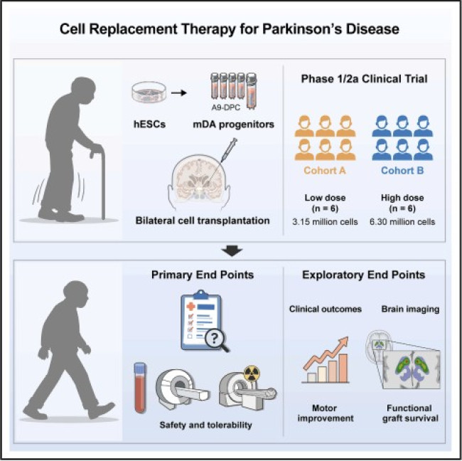배아줄기세포를 이용한 파킨슨병 치료 임상시험 모식도
